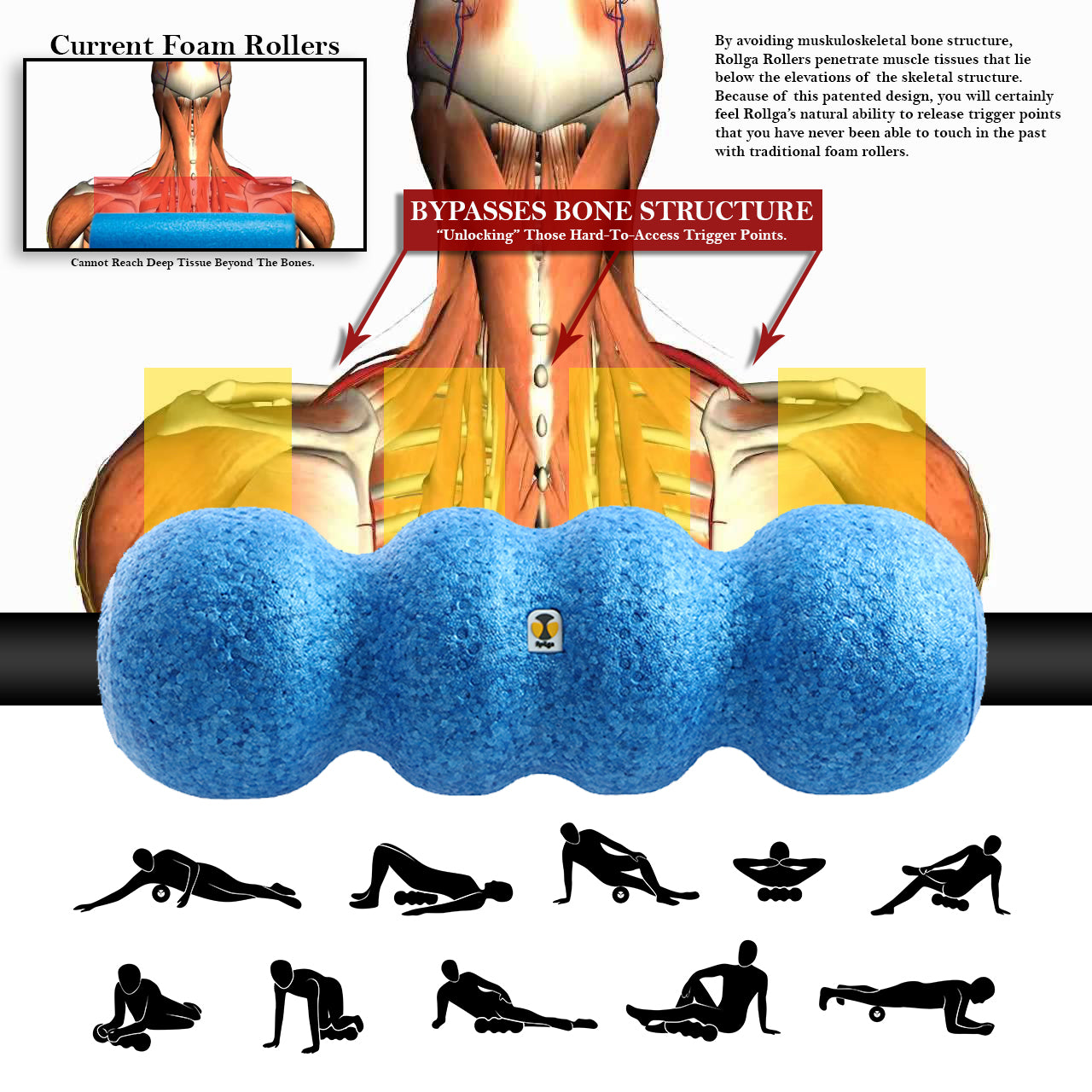 Muscle Ramp Roller Muscle Roller