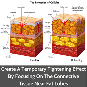 Rollga OCTO - Anti Cellulite Massage Tool